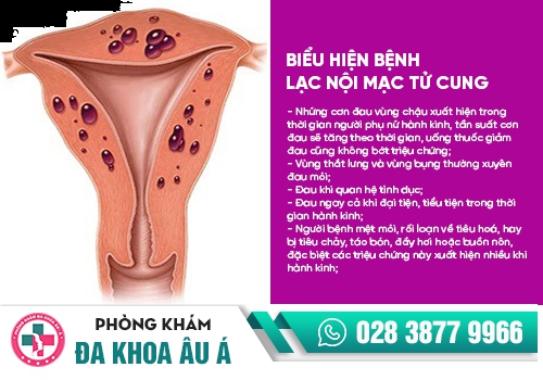 Lạc nội mạc tử cung dẫn đến tình trạng đau rát khi quan hệ
